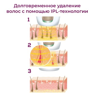 прибор световой эпиляции beurer ipl 5800 pure skin pro - фото 25869